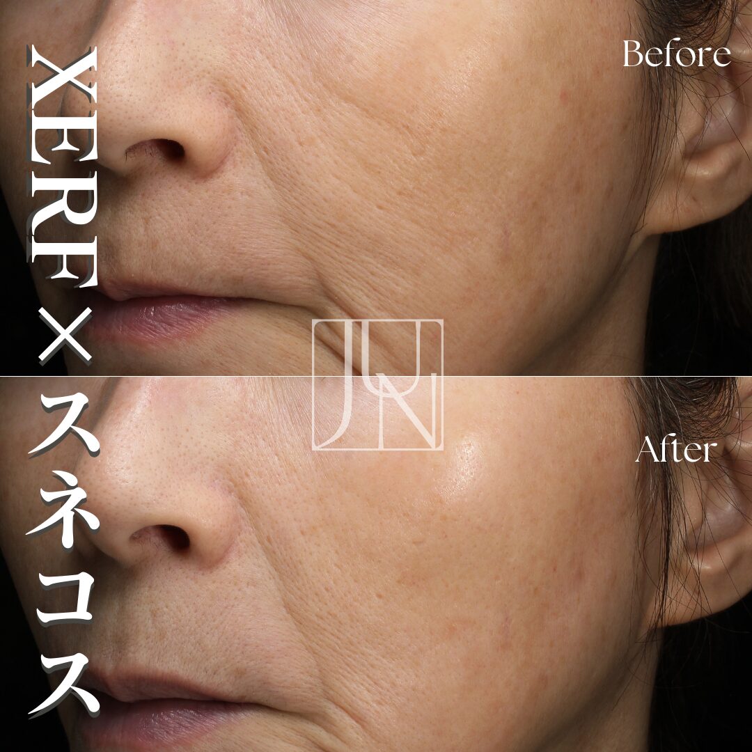 XERF(ザーフ)×スネコスパフォルマ