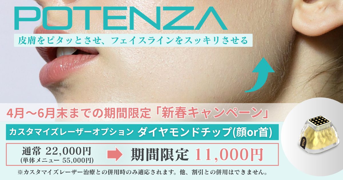 【4月〜6月限定】カスタマイズレーザーを受ける方へ。大人気「ポテンツァ/ダイヤモンドチップ」が特別価格！